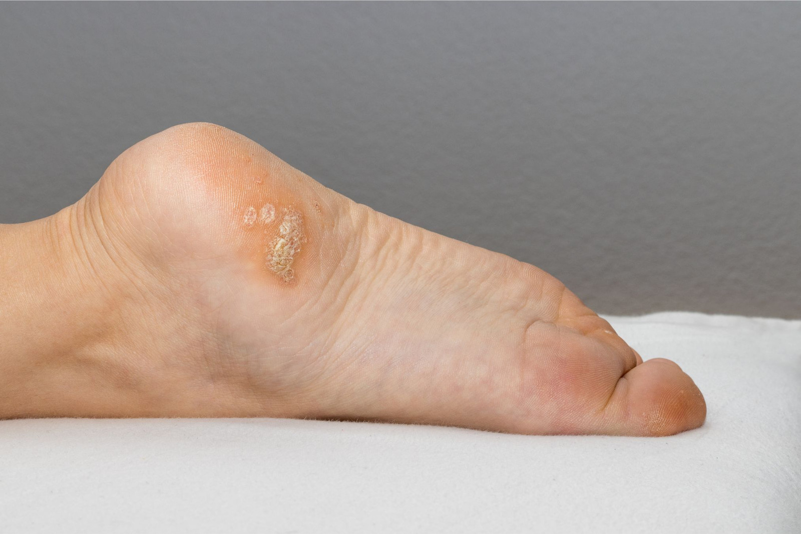 Examination for foot skin condition