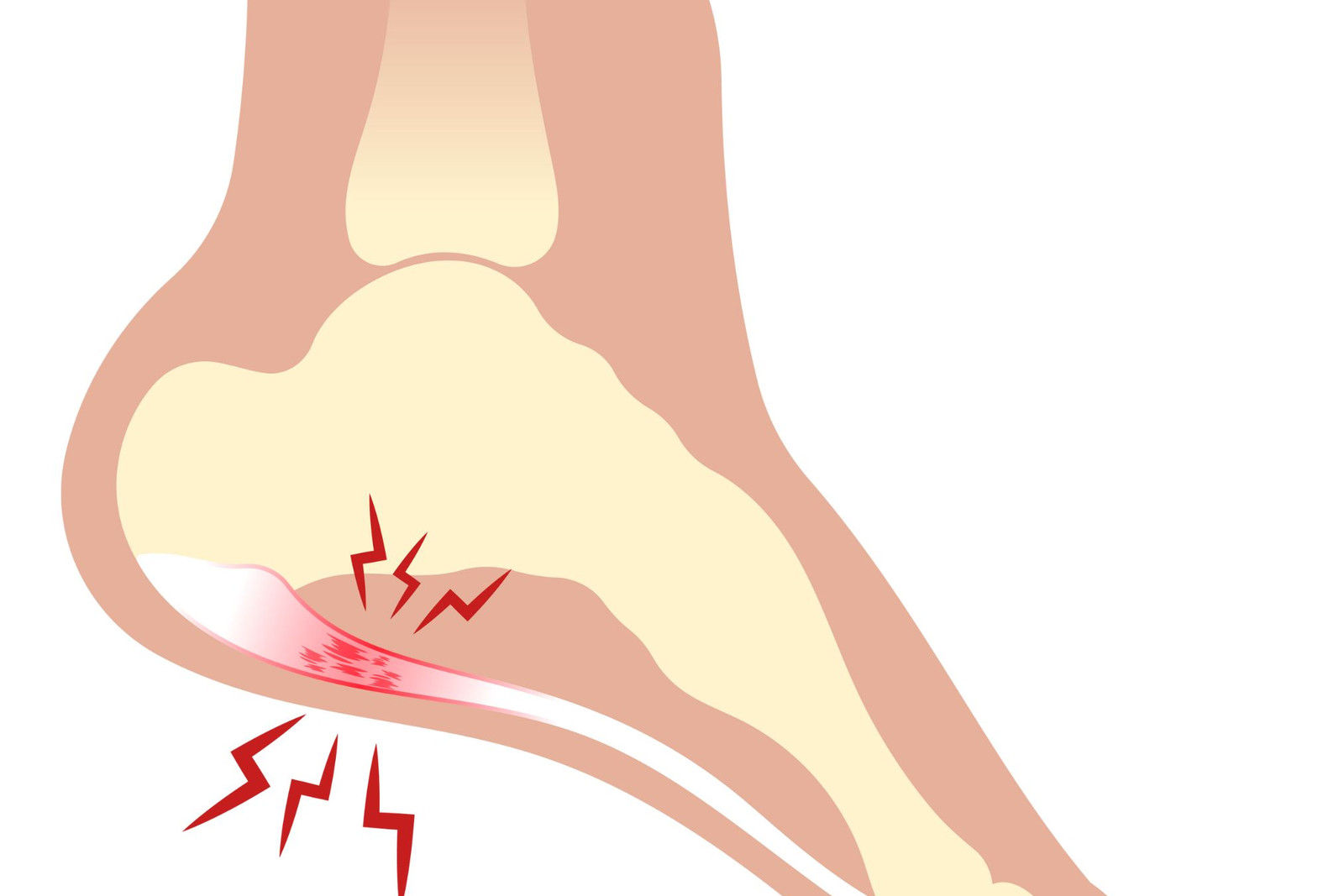 Patient receiving a heel pain examination